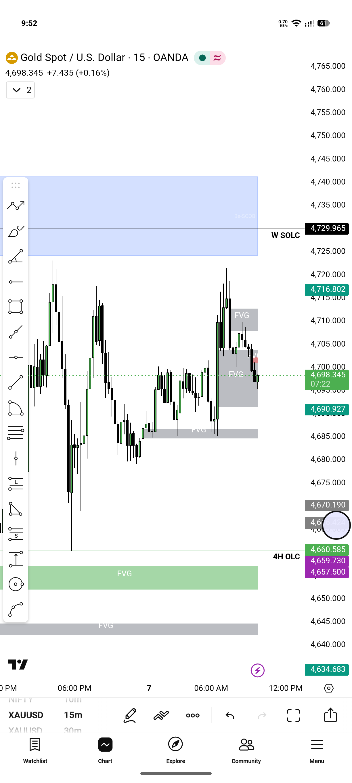 XAUUSD Gold Price Analysis Today – Bearish Breakdown, Smart Money Setup & Trade Plan (29 April 2026)